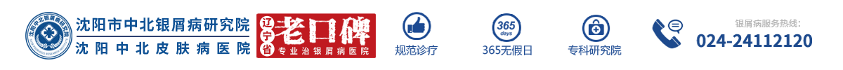 「沈陽中北醫(yī)院」-沈陽市銀屑病醫(yī)院-沈陽哪里治牛皮癬好-沈陽市治銀屑病有什么好醫(yī)院